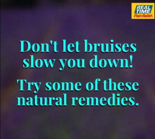 natural-remedies-for-bruises