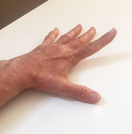hand-exercises-improve-finger-dexterity-and-grip
