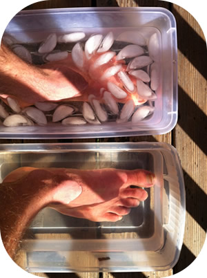 Contrast baths can lessen pain from achilles tendonitis