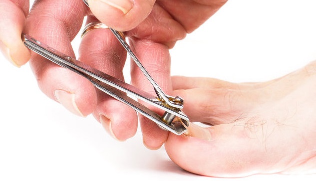 trim-toenails