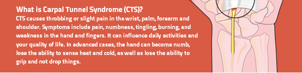 Tips to Relieve Carpal Tunnel Syndrome