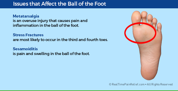 Painful conditions that affect the ball of the foot