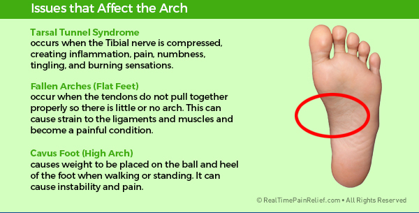 Painful conditions that affect the arch